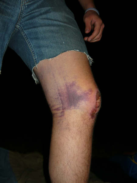 Garrets knee post ghetto big air